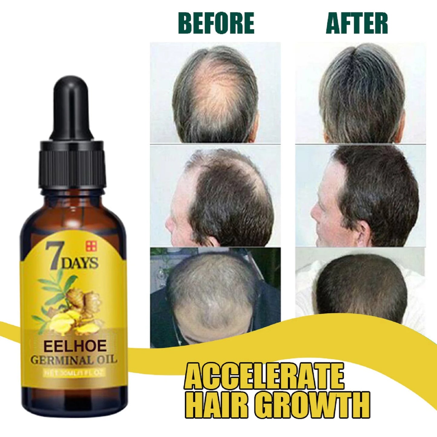 EELHOE Ginger Hair Growth Oil Natural Anti-Hair Loss Treatment 40ml