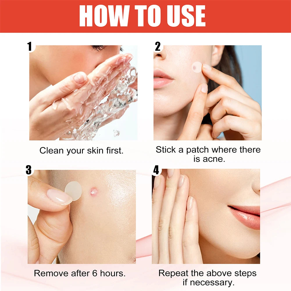240 Pcs Heart and Star Shape Acne Patches for Zits and Blemishes Care