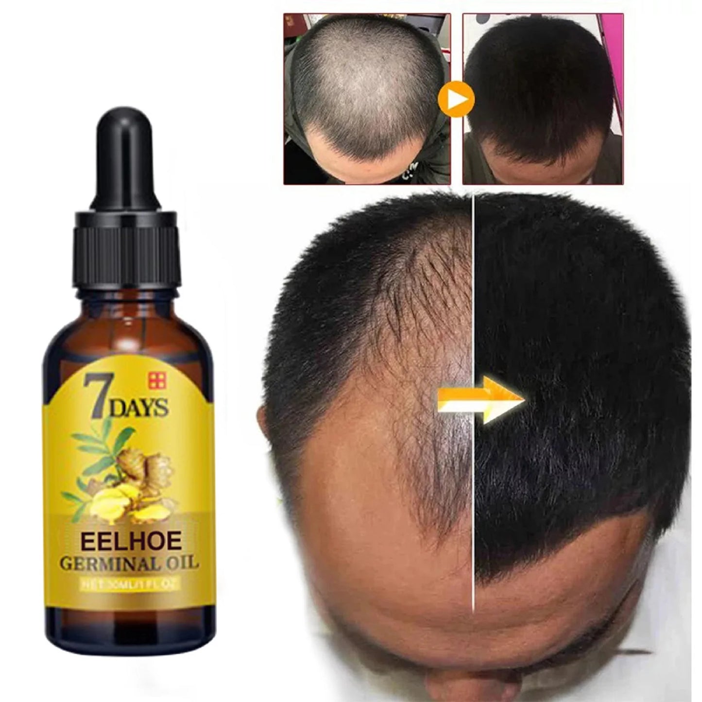 EELHOE Ginger Hair Growth Oil Natural Anti-Hair Loss Treatment 40ml